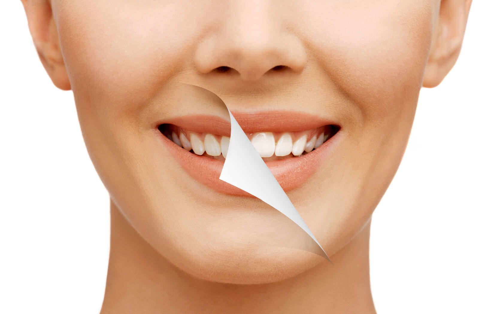 A person smiles widely after a dental cleaning. We can see what their teeth look like before and after having their teeth cleaned.