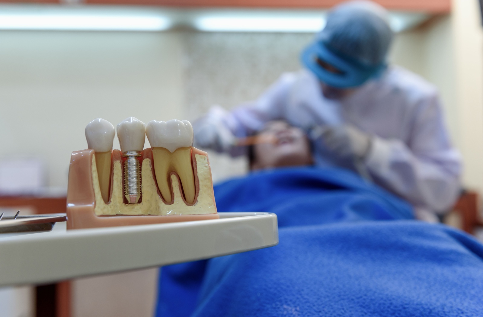 Dental implant model showing tooth structure with patient lying in background during dental procedure
